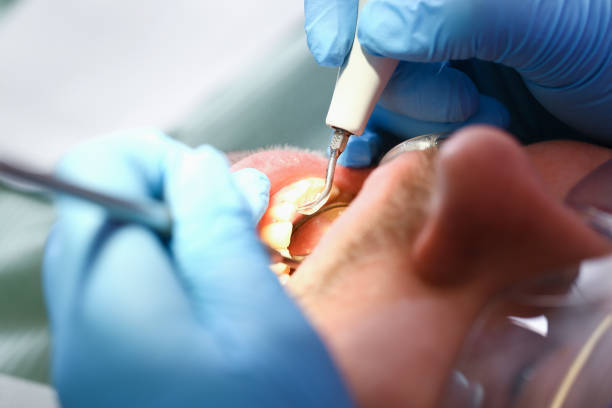 Best Knocked-Out Tooth Emergency  in Leadville, CO